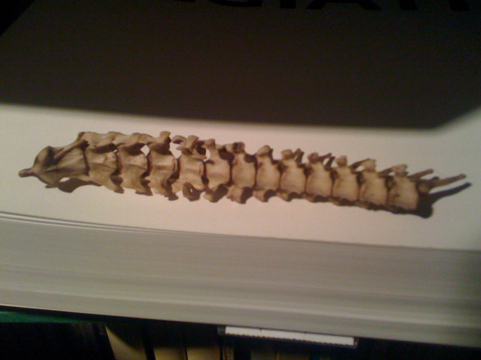 sezione di colonna vertebrale - di cosa?